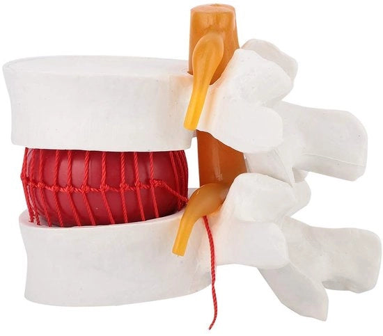 1.5 - Modello Anatomico - Modello in Plastica - Modello di Dimostrazione - Colonna Vertebrale Lombare - Disco Intervertebrale Molle - Modello Anatomico