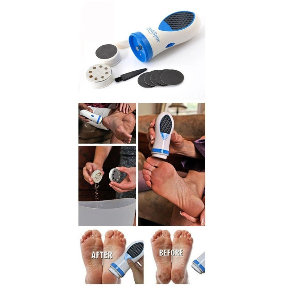 Trade Shop - Kit Pedicure Per Pelle Secca E Calli Cura Del Piede Con 2 Accessori Pedi Spin -